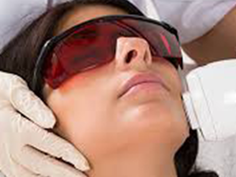 Laser hair removal in bangalore